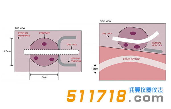 美國CIRS 053S 053L 053L-EF前列腺MRI測試體模2.png