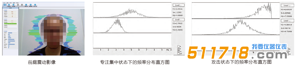 JT3010 心理健康狀態(tài)檢測.png
